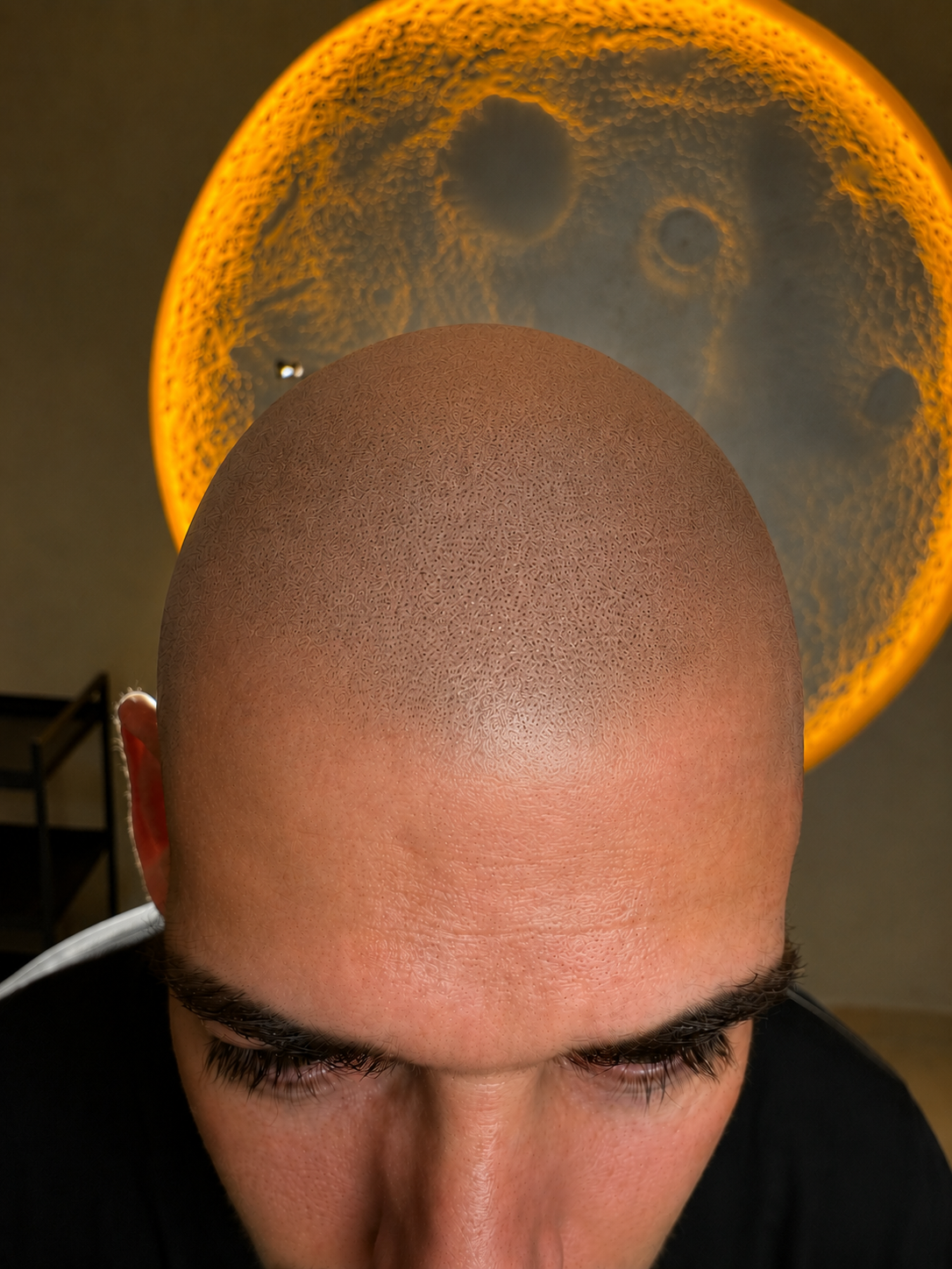 StelarScalp